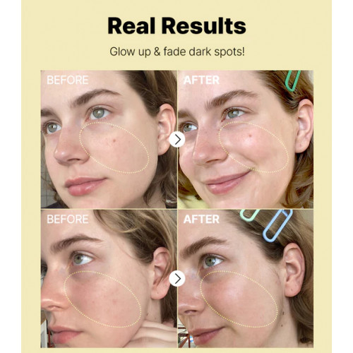 COSRX Advanced The Vitamin C 23 Serum Veido serumas 20g