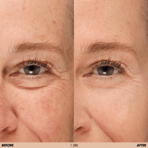 Make Up For Ever HD Skin Concealer Daugiafunkcinis maskuoklis 5ml