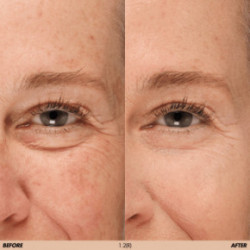 Make Up For Ever HD Skin Concealer Daugiafunkcinis maskuoklis 5ml