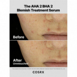 COSRX The AHA 2 BHA 2 Blemish Treatment Serum Serumas problematiškai odai 50g