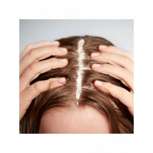Ameliorate Transforming Scalp Serum Jautrios galvos odos serumas 125ml