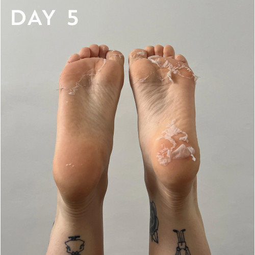 Maskology Foot Peel Professional Foot Treatment Nulupamoji pėdų kaukė - kojinės 1 pora