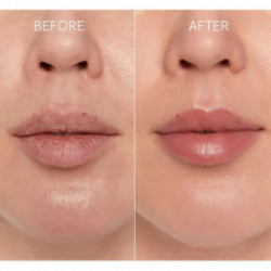 Glov Kiss&Kiss Lip Exfoliating Set Lūpų šveitimo pirštinių rinkinys 1 vnt.