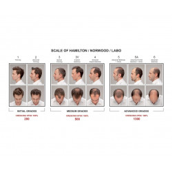 Crescina Re-Growth HFSC 200 Complete Treatment Man Plaukų augimą skatinantis kompleksas vyrams 20amp. (10+10)