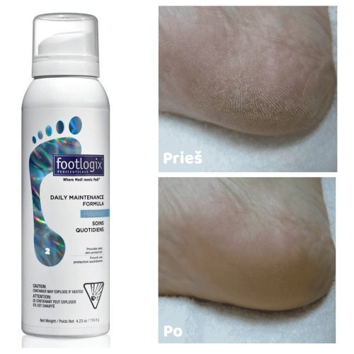 Footlogix Daily Maintenance Formula Putos kasdieninei pėdų priežiūrai 125ml
