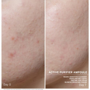 Babor Ampoule Concentrate Active Purifier Iluampullid probleemsele nahatüübile 7x2ml